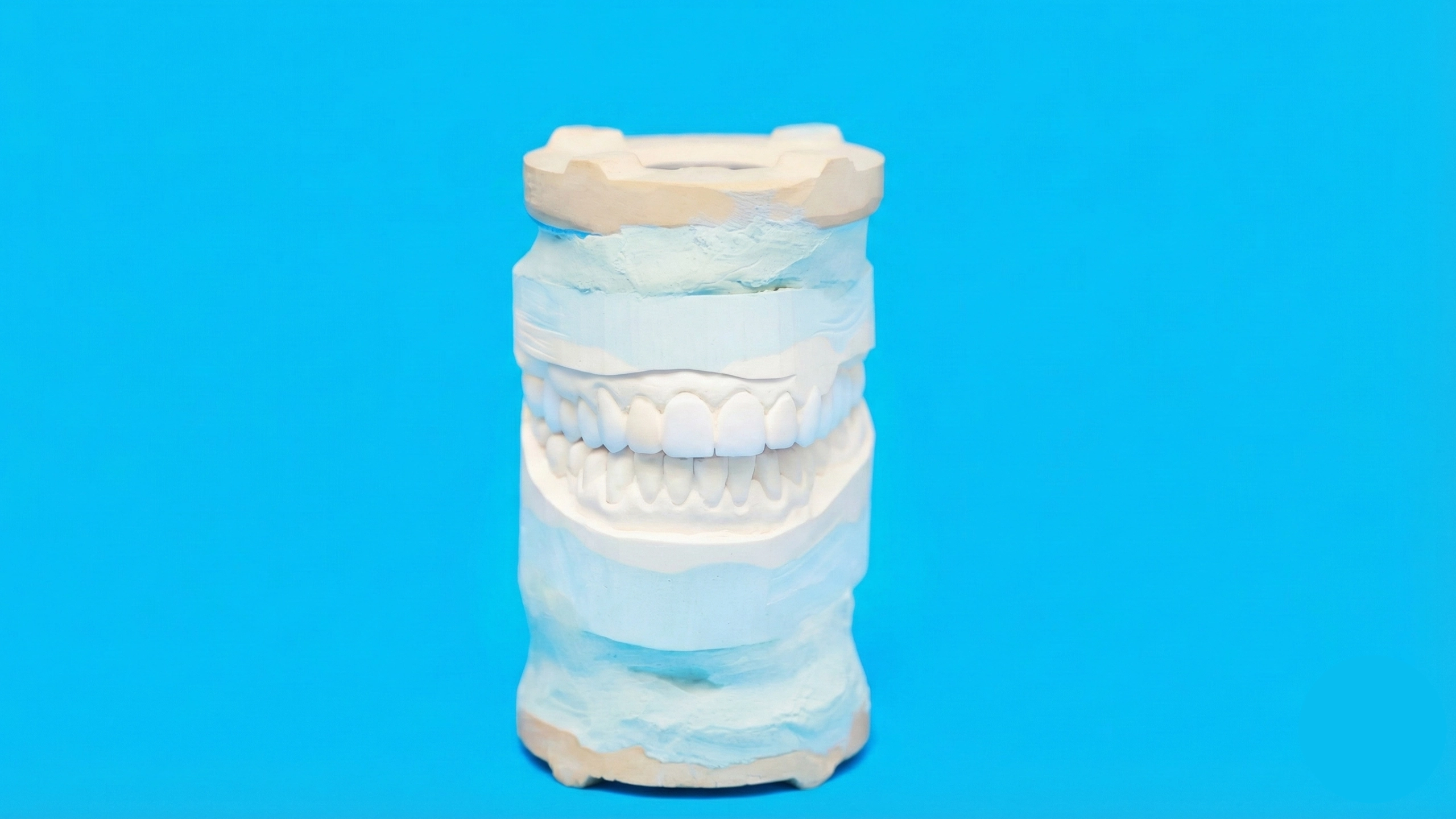 Präziser Zahnersatz Hamburg